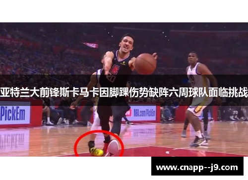 亚特兰大前锋斯卡马卡因脚踝伤势缺阵六周球队面临挑战